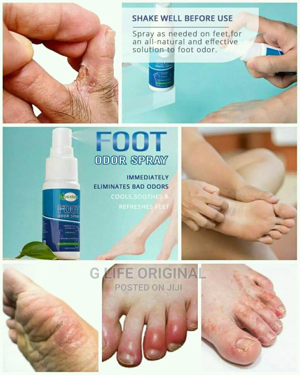 Foot Spray