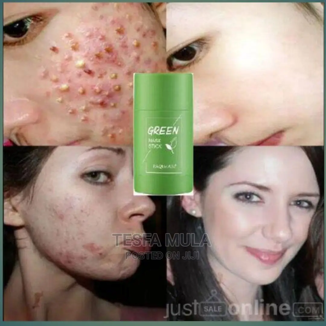 Green ለብጉር ማድያት ያጠፋል