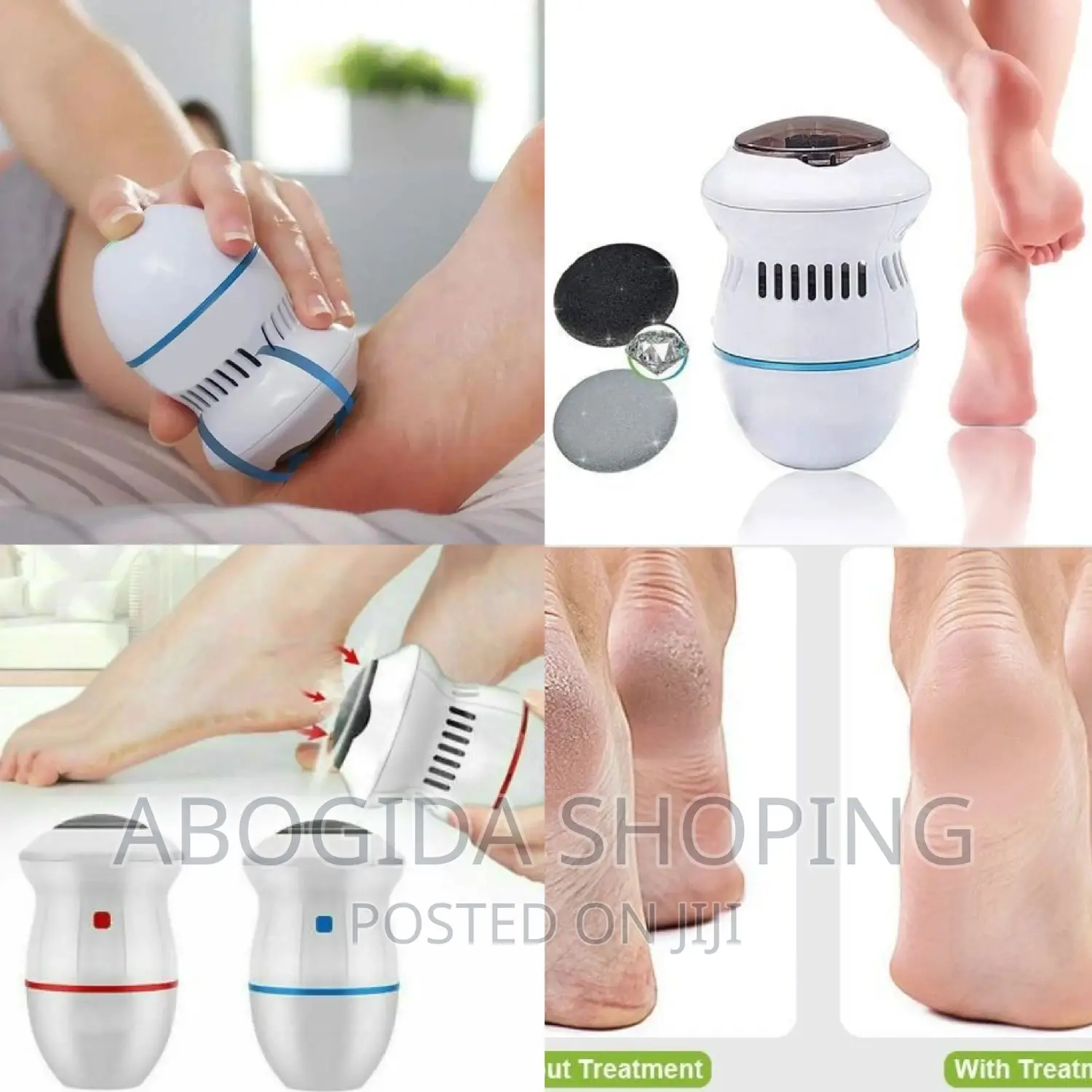 Callus Remover With Built-in Vacuum!
