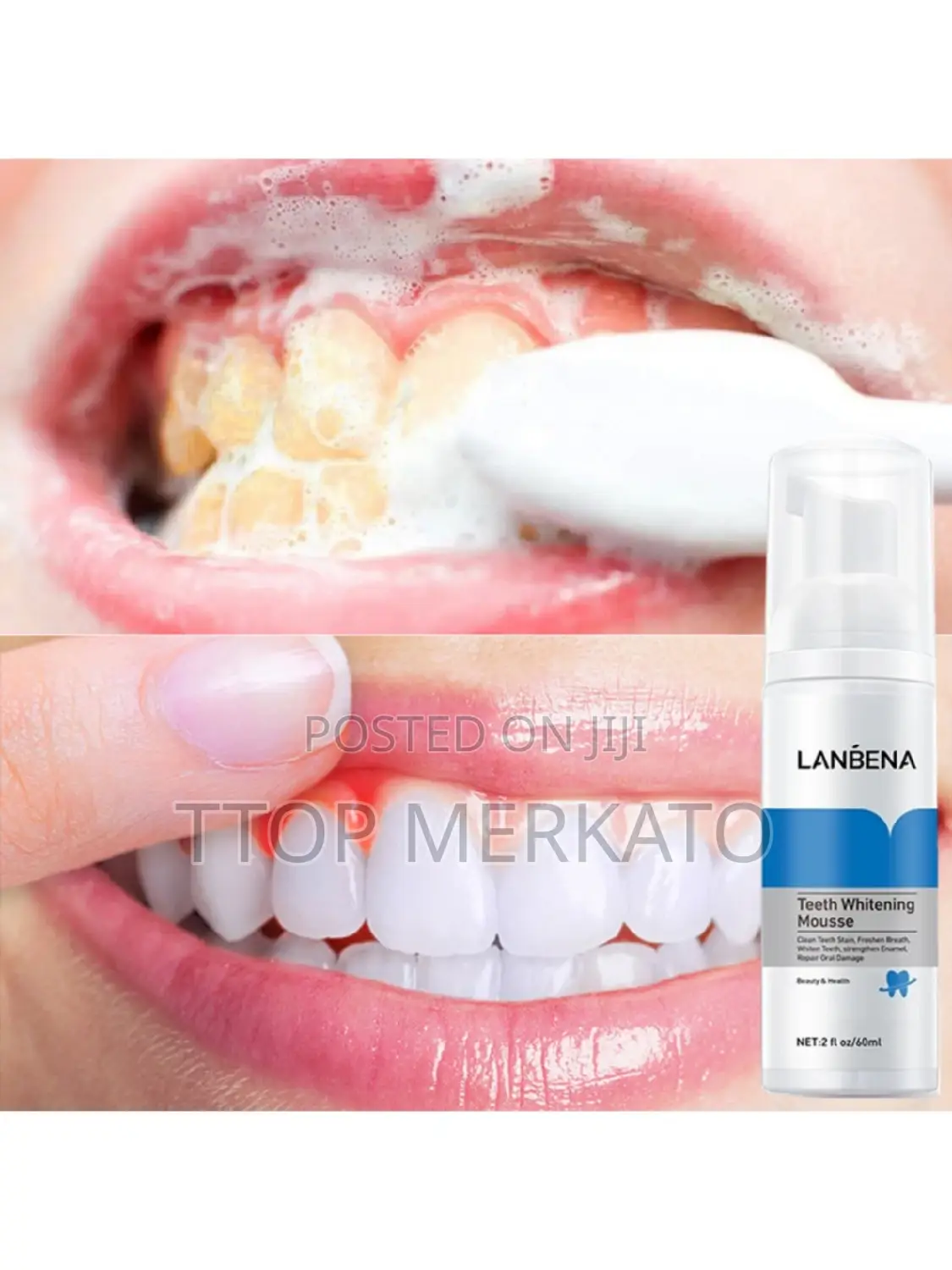 Lanbena Teeth Whitening