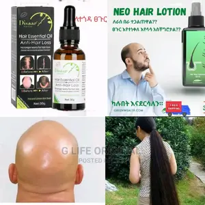 Photo - የፀጉር መመለጥን ማስቀረት ከጀመርን ድፍን ሁለት አመታችን!