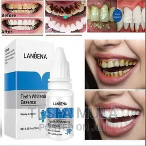 Photo - Whiting ቢጫ ጥርስ ነጭ ያደርጋል