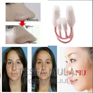 Photo - የተጣመመ የተዘረጠጠ አፍንጫ ይመልሳል