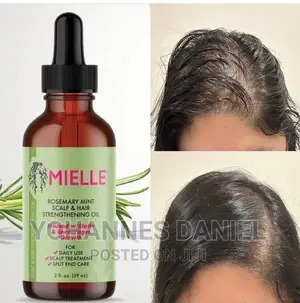 Photo - Mielle Rosemary Oil