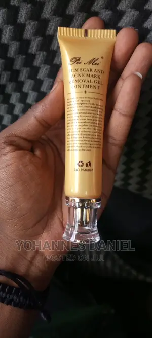 Photo - TCM Scar Removal Cream