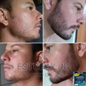 Photo - Minoxidil የወንዶች ፀጉር እና ፂም ማሳደግያ Original