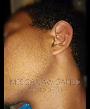 Photo - ጺም ማብቀል ለምትፈልጉ Kirkland Kminoxidil and Dermaroller for Beard