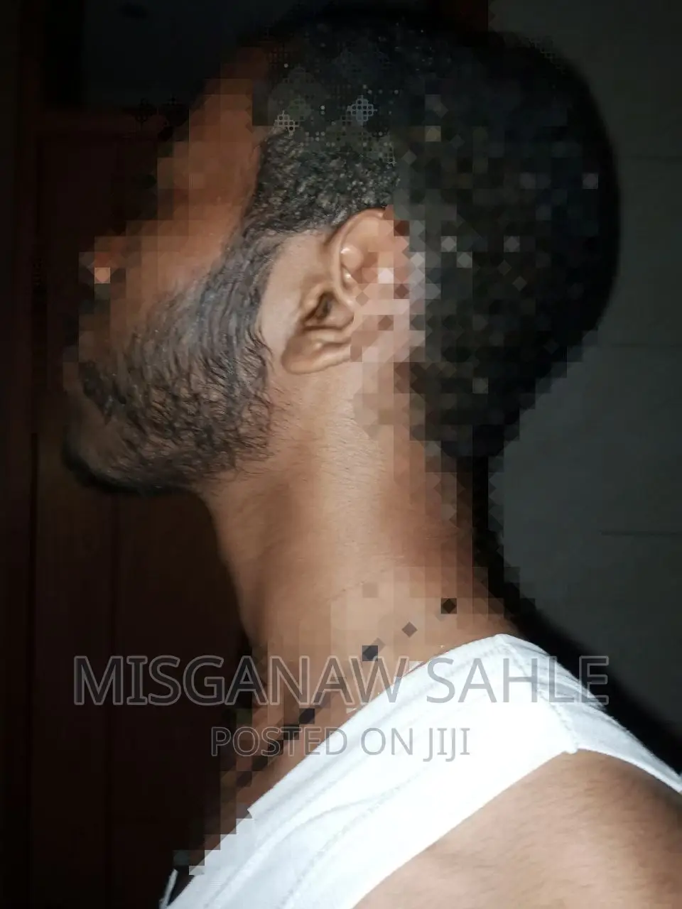 ጺም ማብቀል ለምትፈልጉ Kirkland Kminoxidil and Dermaroller for Beard