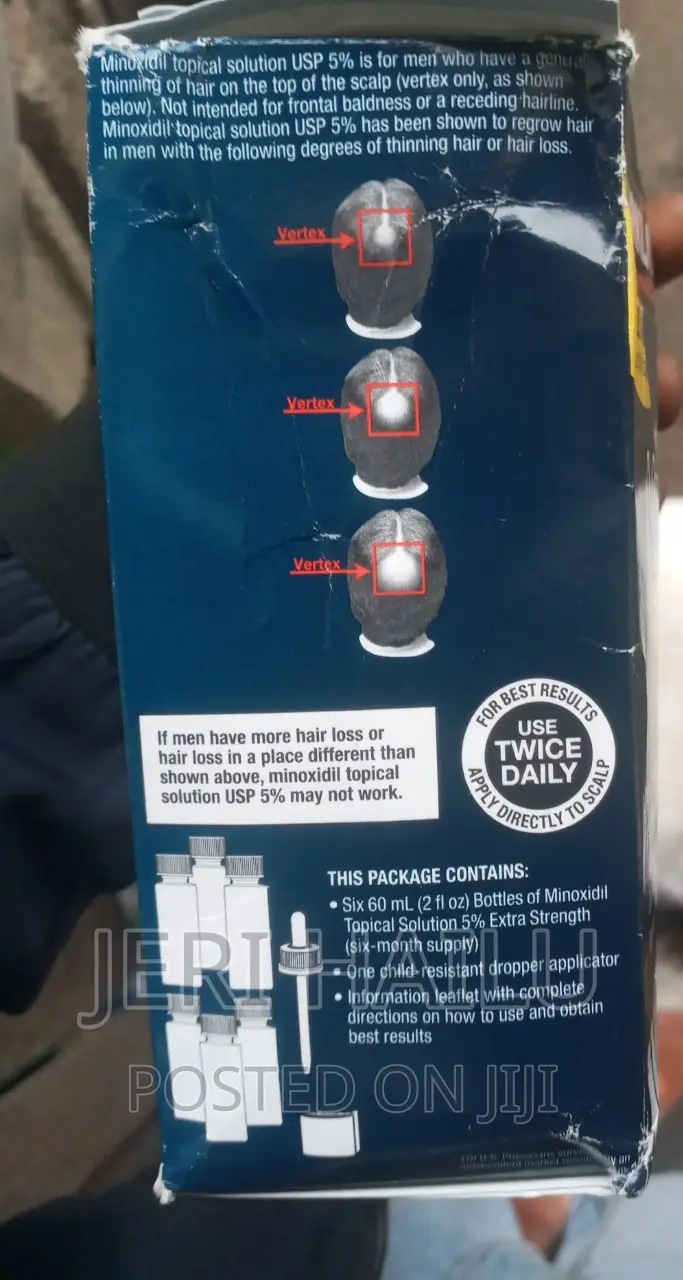 Minoxidil 5%