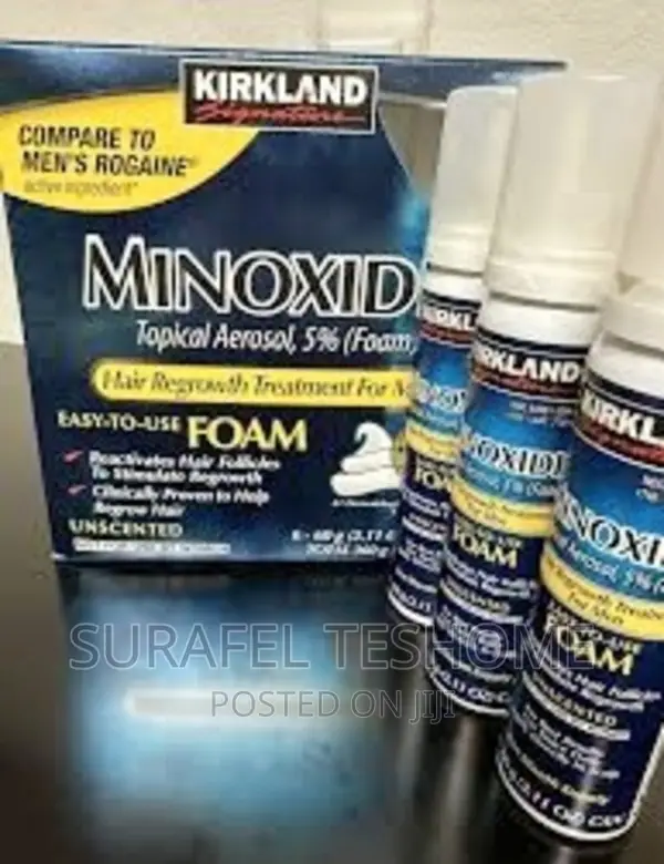 Minoxidil Hair Growth and Treatment