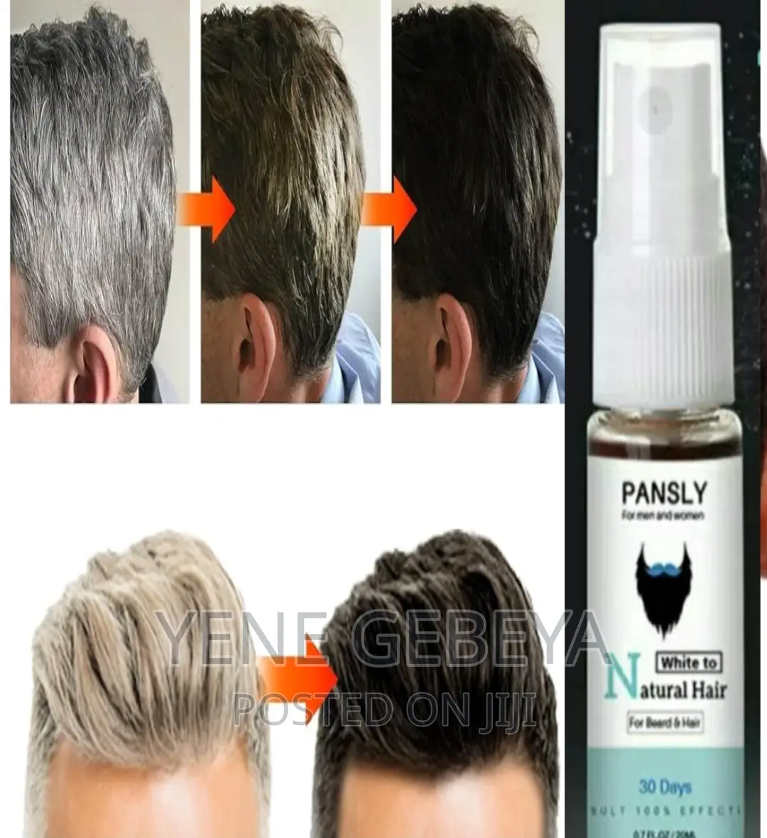 ሽበትን በዘላቂነት ማጥፊያ