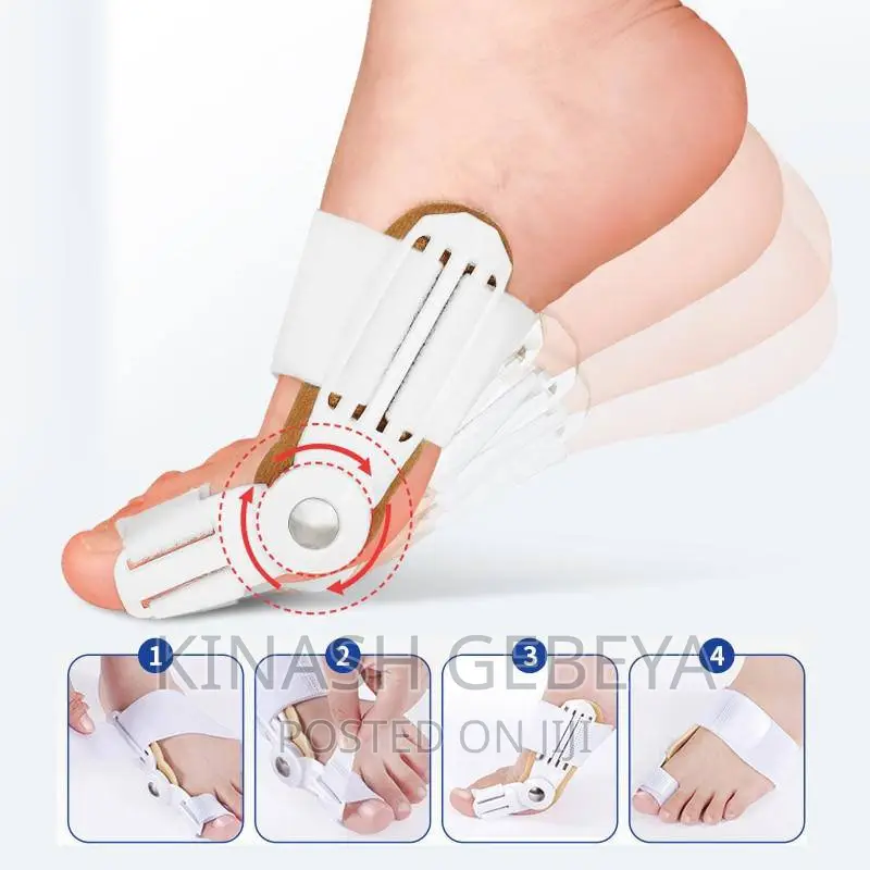 የእግር ጣት ማስተካከያ(Leg Toe Corrector)