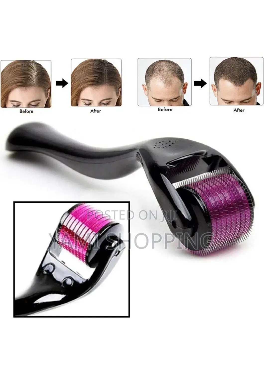 Original Derma Roller