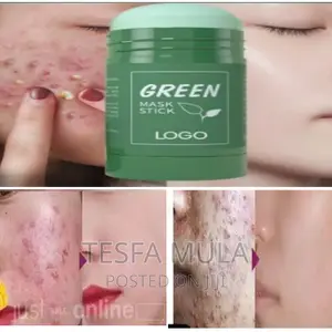 Photo - Maks ፊት ላይ ብጉር ማድያት ያጠፋል