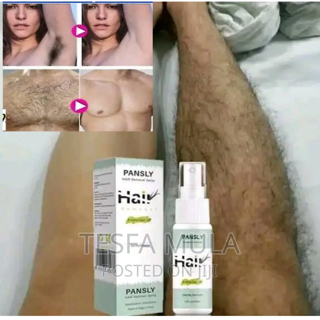 Hair Removed ፀጉር እንዳይመለስ አድርጎ ያጠፋል