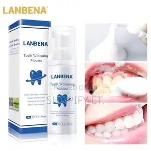 Lanbena Teeth Whitening