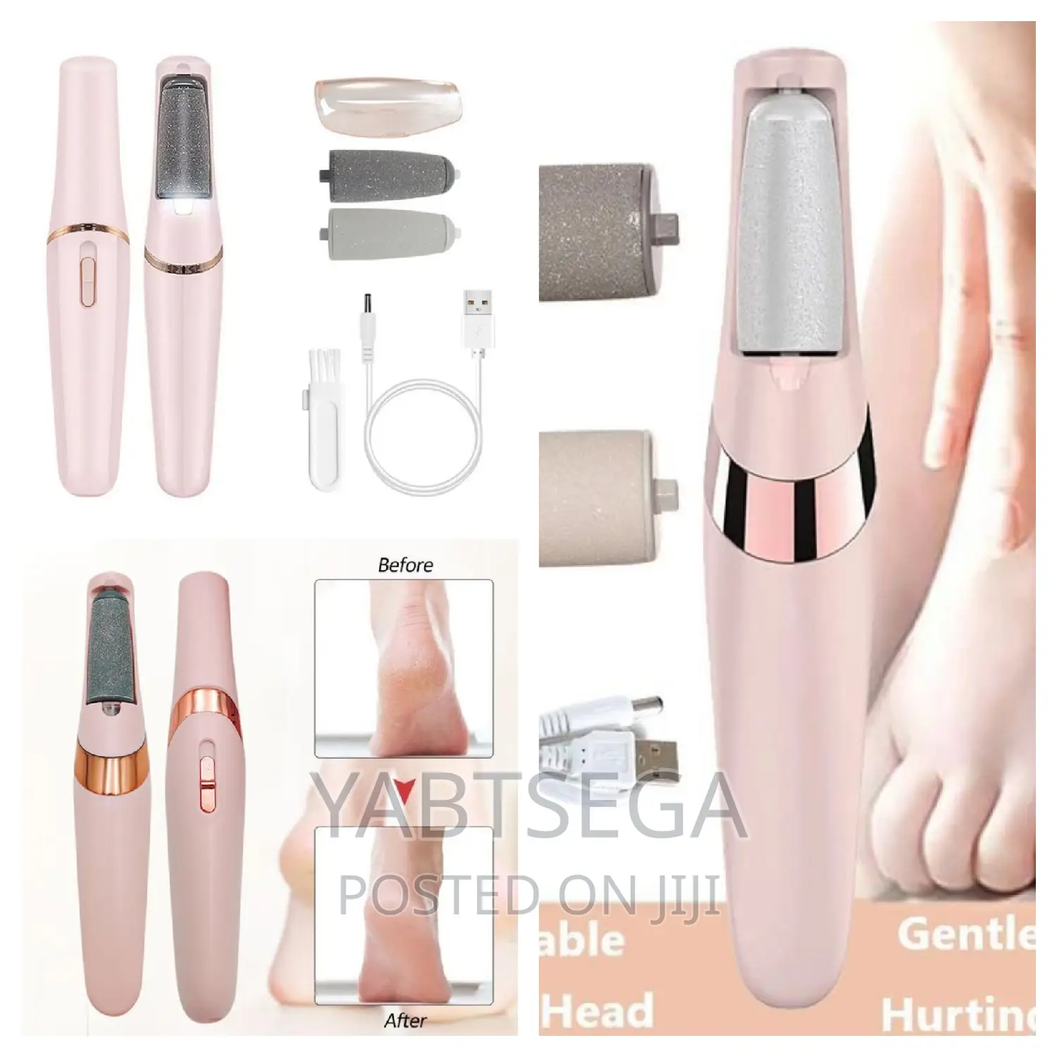 Find Back Callous Remover