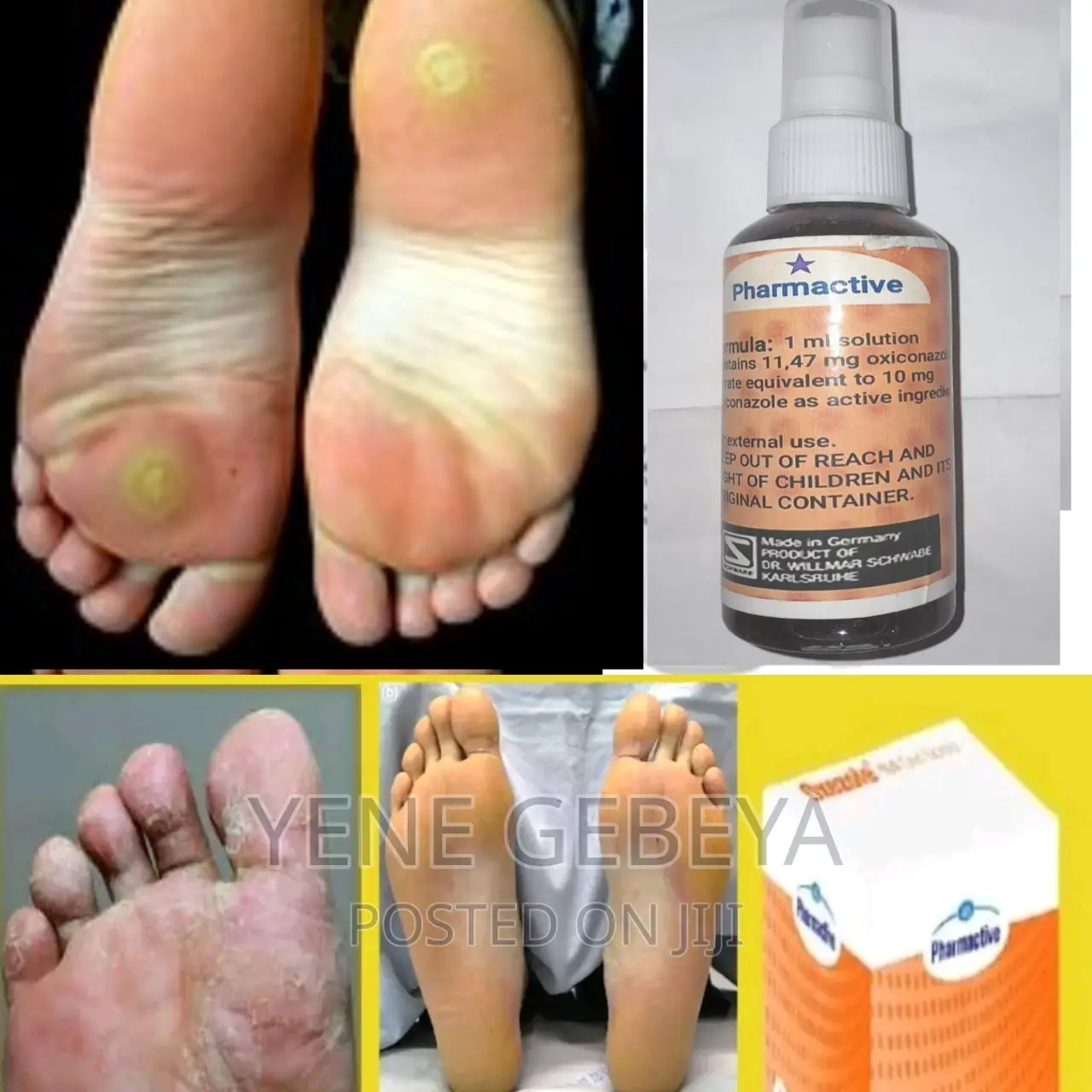 Anti Fungal የእግር ሽታ ማጥፊያ