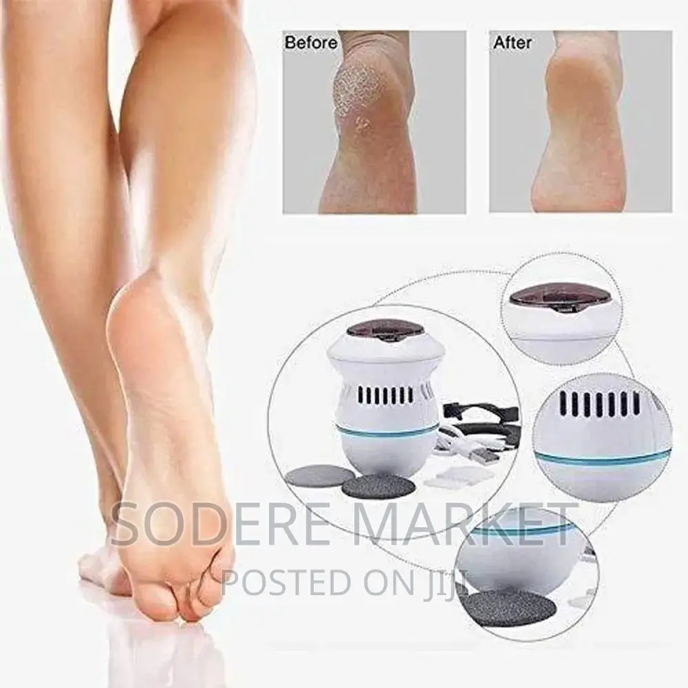 Electric Callus Remover Removes Calluses