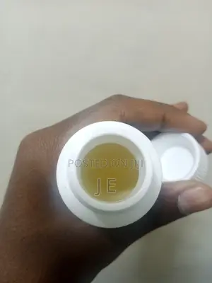 Photo - Kirkland Minoxidil ለፀጉር እና ለፂም እድገት