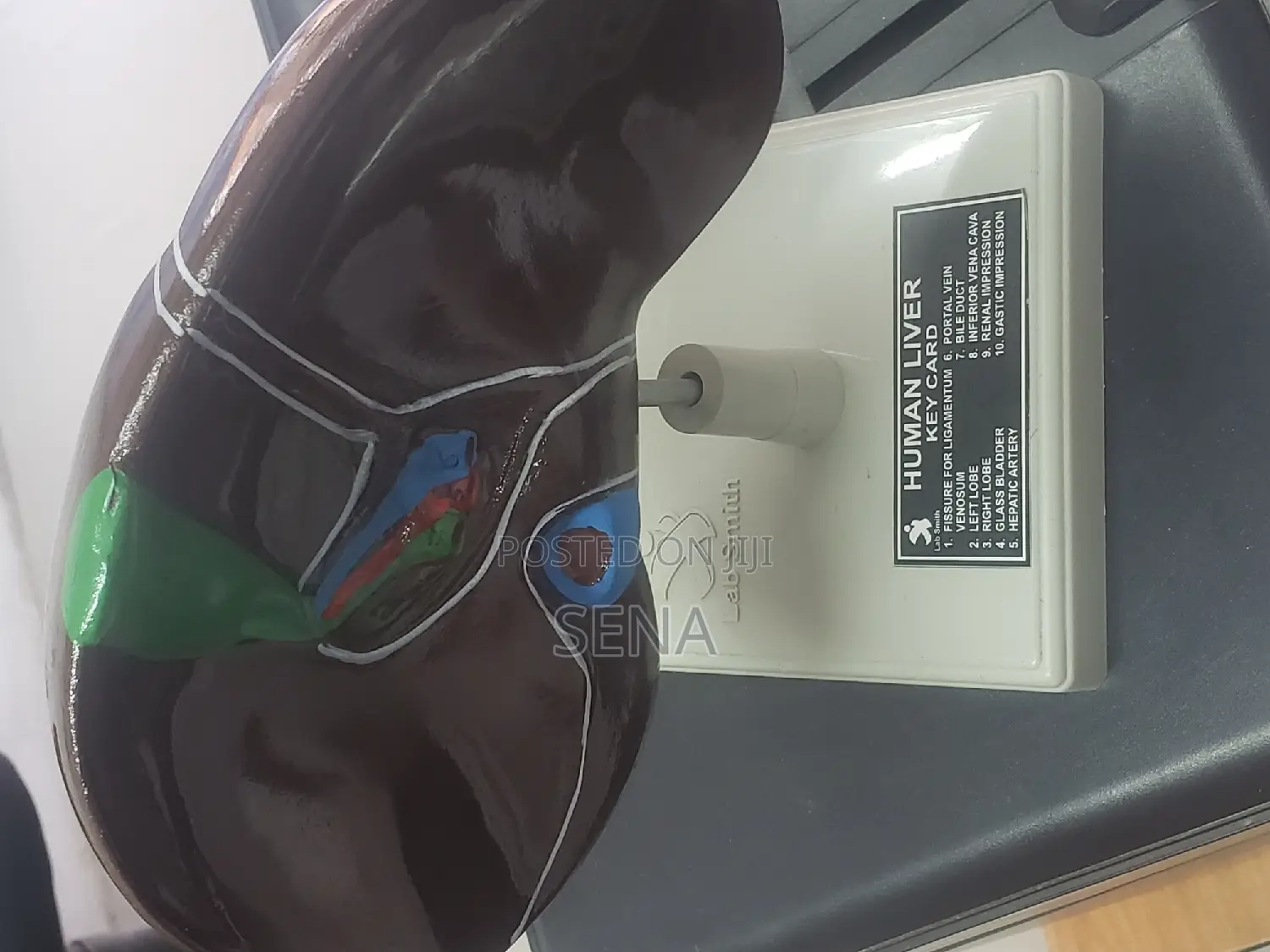 Liver Model