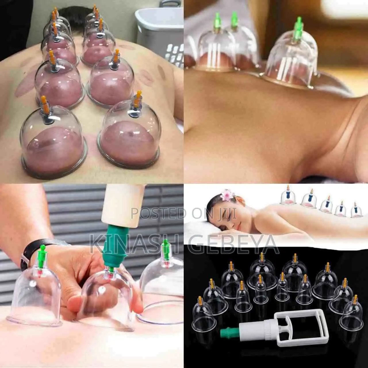 High Quality Traditional Therapy( የchina ጤና መጠበቂያ ዋግምት)