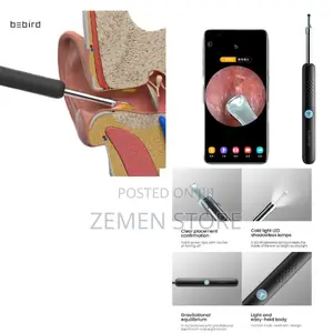 Photo - Smart Video Visual Ear Cleaner