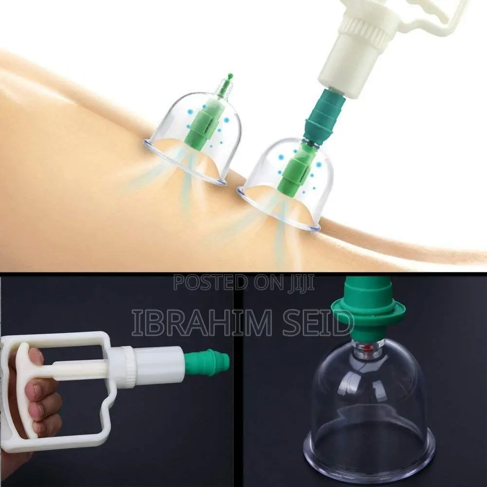Cupping Suction Remedy Therapy