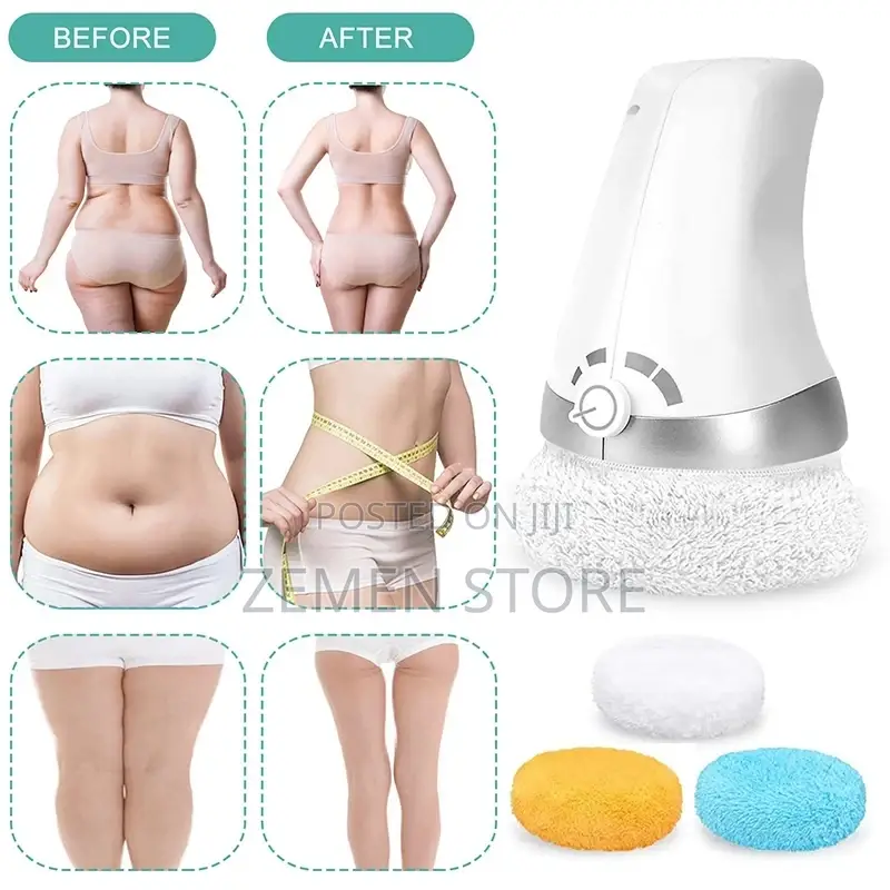 Sculpt Body Massager የሰውነት ሸንተረርን የሚያጠፋ Stretch Mark Remover