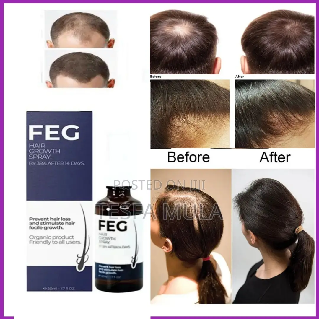 Feg Hair Oil የተመለጠ የሳሳ የሚነቃቀል ፀጉር ይመልሳል
