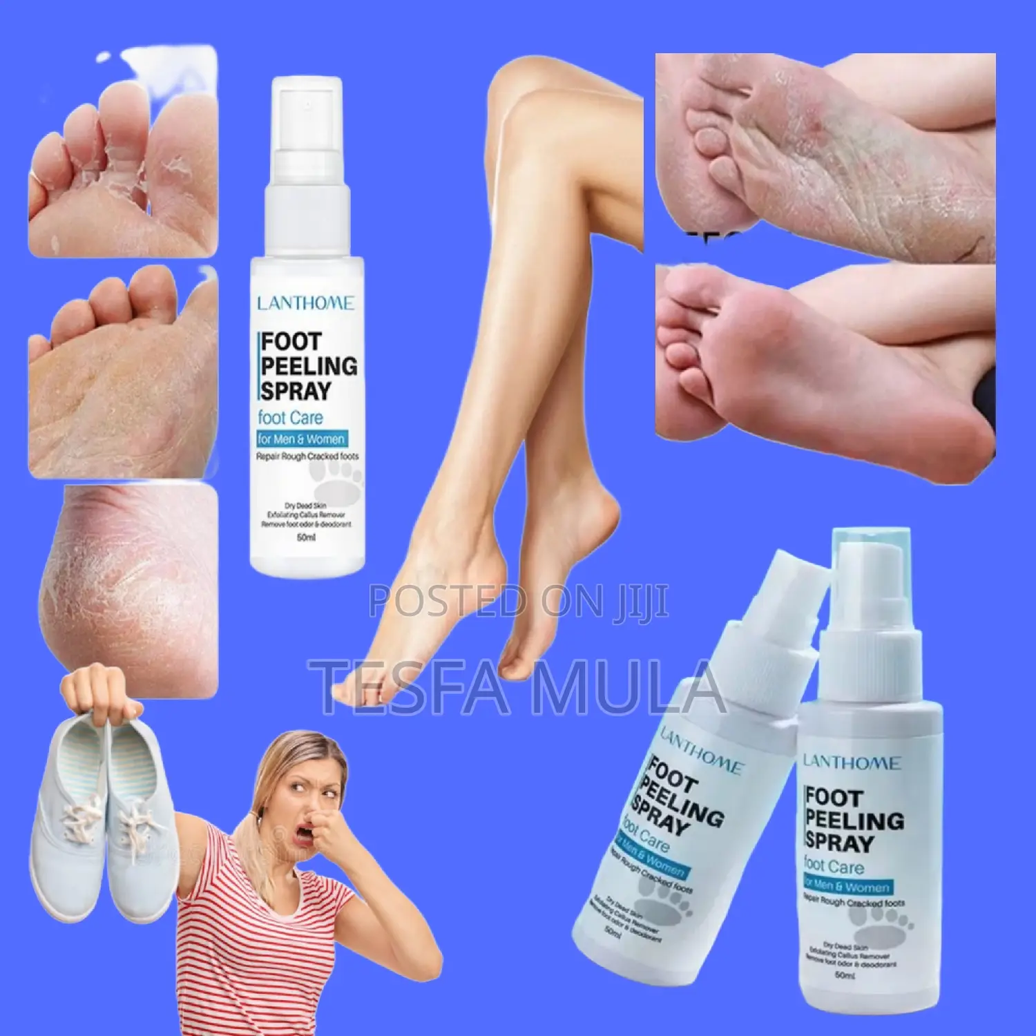 Foot Spray የሚሸት የሚያልበው እግር ፋቱን መዳጊት