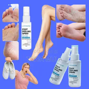 Photo - Foot Spray የሚሸት የሚያልበው እግር ፋቱን መዳጊት