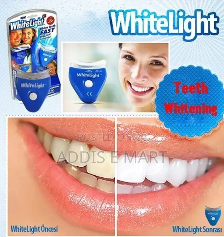 Dental White [ጥርስ ማንጫ ] ፈገግታወን ልንመልስ