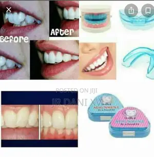 Photo - የጥርስ ሚያስተካክል