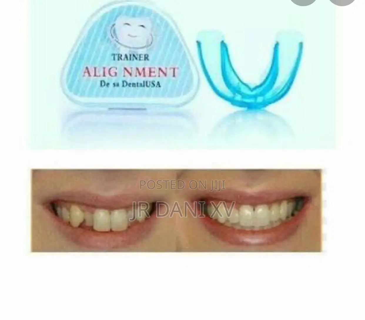 የጥርስ ሚያስተካክል