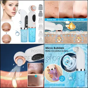 Photo - Facial Cleaner and Black Spots Remover