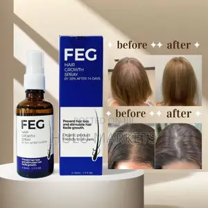 Photo - Usa Feg Hair Growth Spray የፀጉር መሳሳት እና መመለጥን የሚመልስ