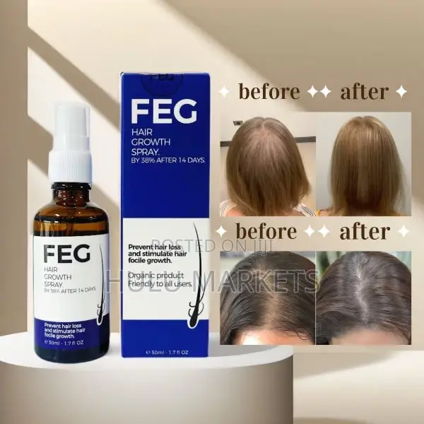 Usa Feg Hair Growth Spray የፀጉር መሳሳት እና መመለጥን የሚመልስ