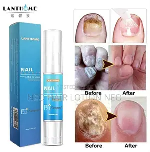 Photo - Lanthome Nail Repair