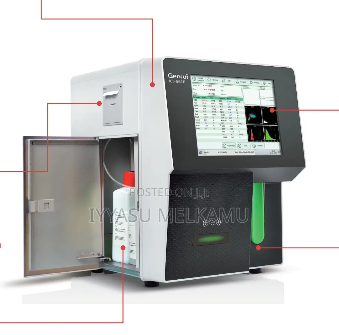 CBC Machine 5-Part Hematology Analyzer