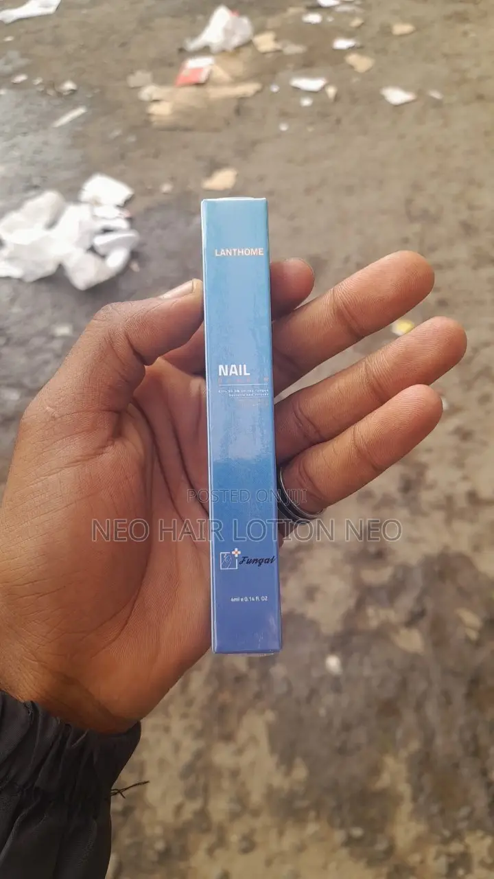 ለጥፍሮ መላ ይዘንሎ መተናል ይደውሉ ይዘዙን