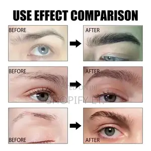 Eyebrow Growth Serum (ቅንድብ ማሳደግያ)