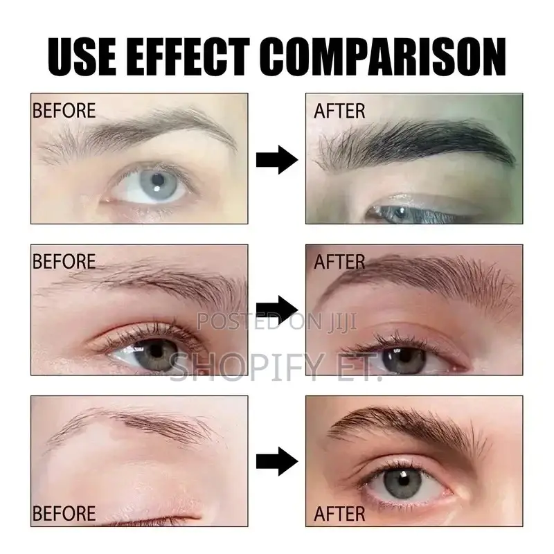 Eyebrow Growth Serum (ቅንድብ ማሳደግያ)