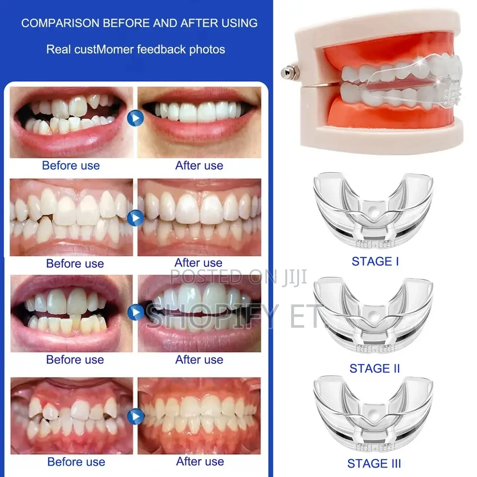 3 Piece Teeth Alignment ( Full Set)