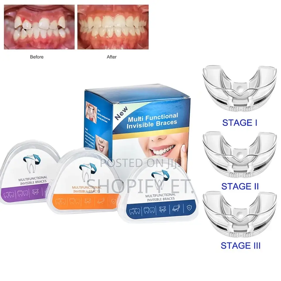 3 Piece Teeth Alignment ( Full Set)
