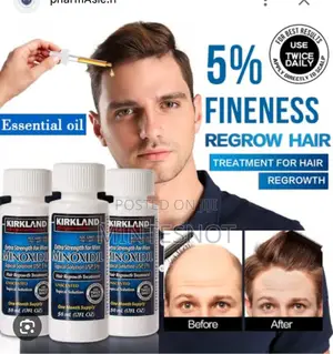 Photo - Kirkiland Minoxidil
