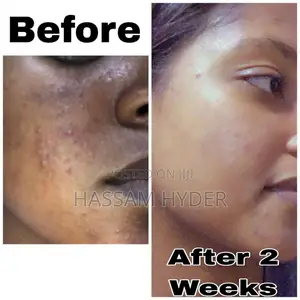 Photo - Albent Face Scrub