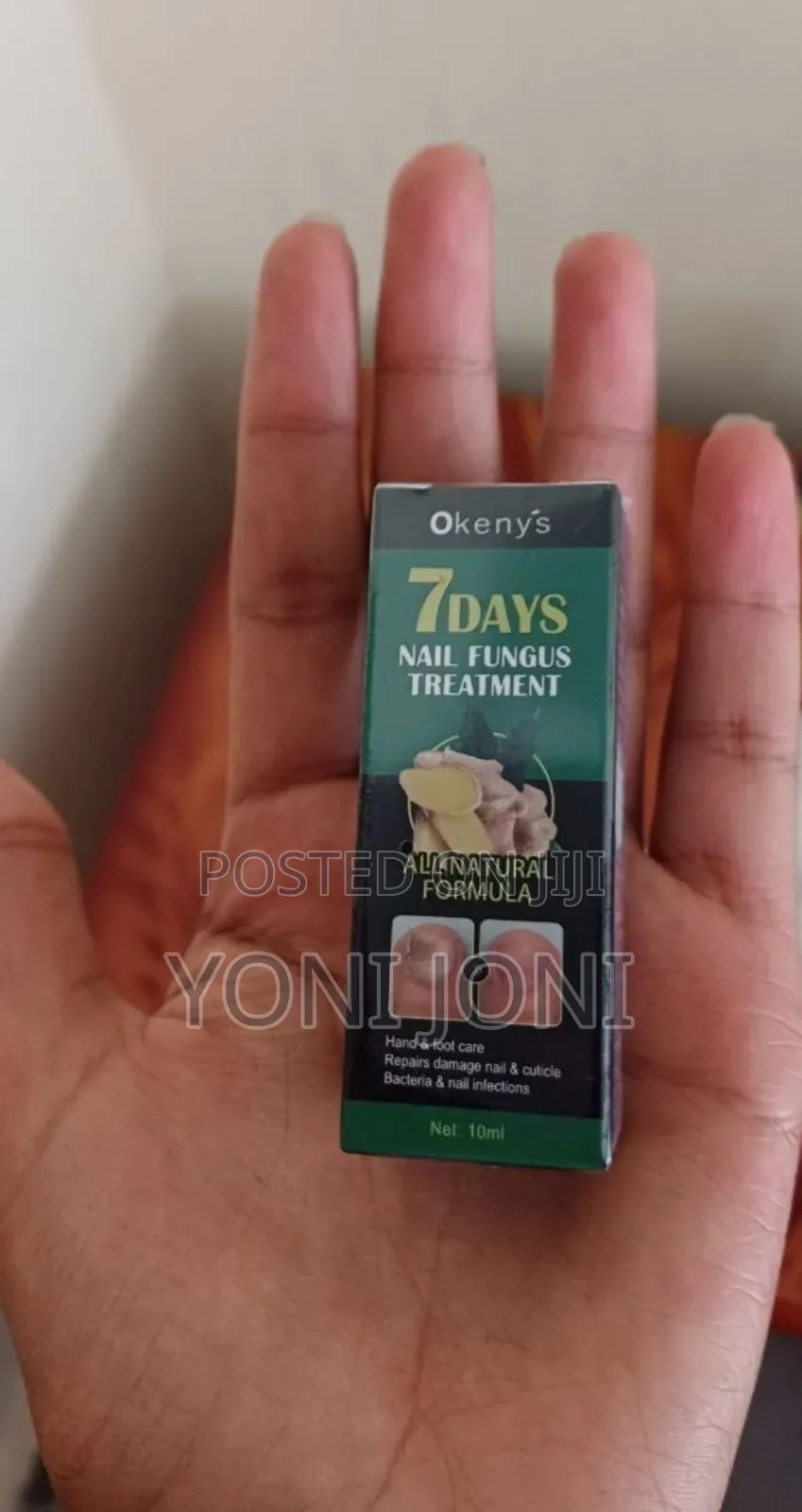 Nail Fungus Treatment, Tefere Metmet Yemiyatefa