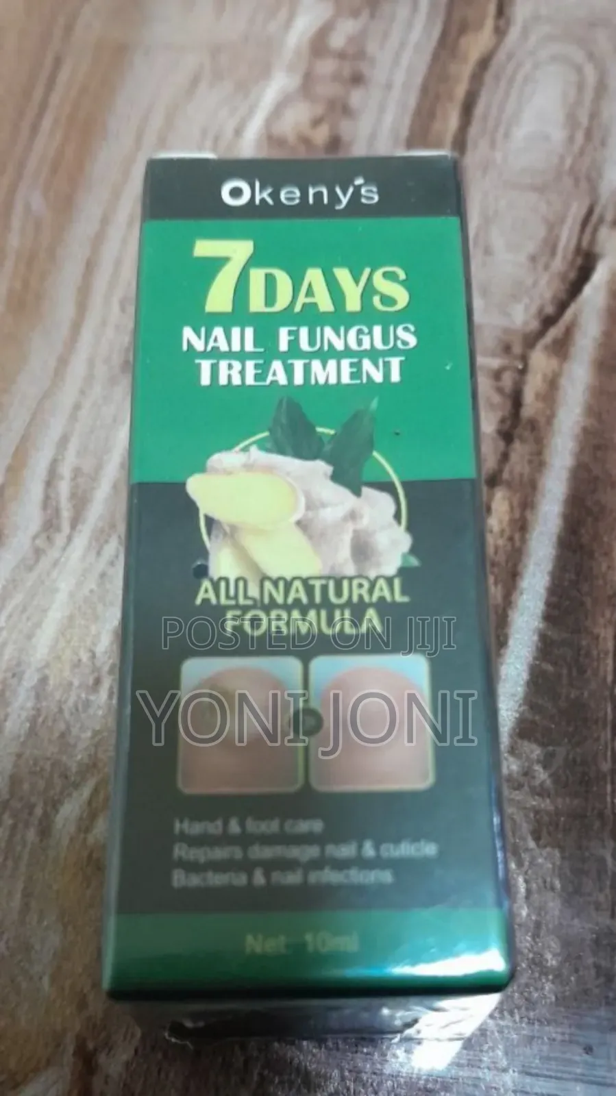 Nail Fungus Treatment, Tefere Metmet Yemiyatefa