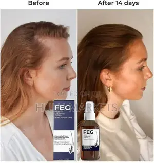 Photo - Feg PLUS+ Hair Growth Spary